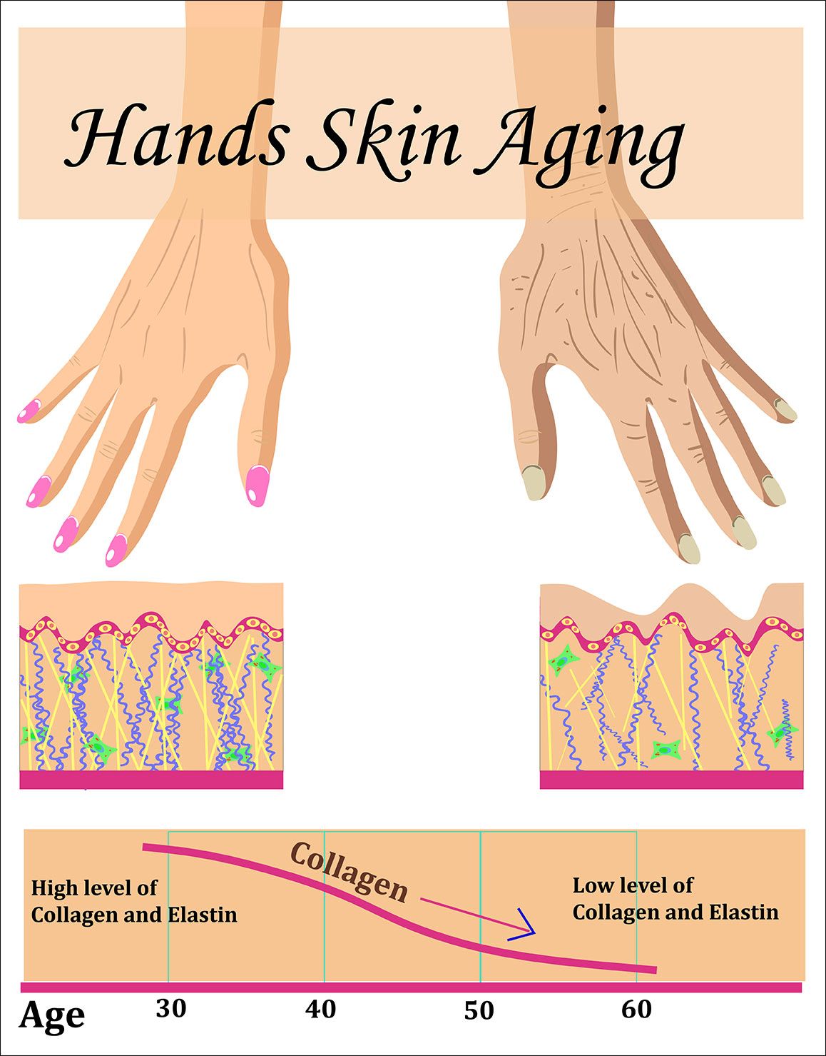 Comparison of collagen production in hands over time