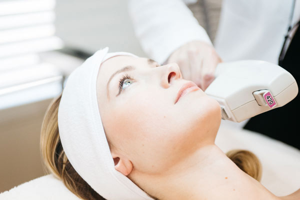 Woman receiving photofacial