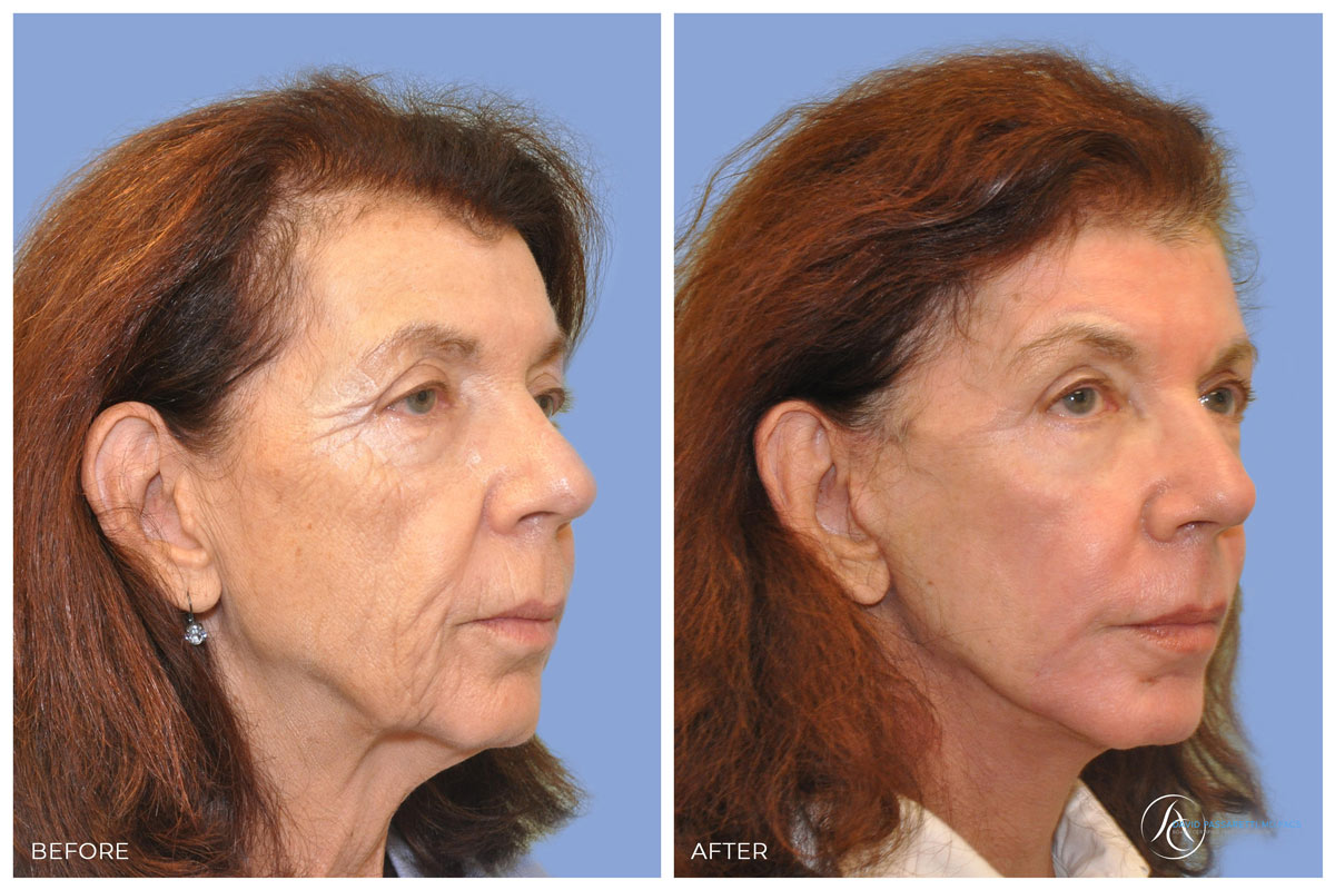 Before and after treatment