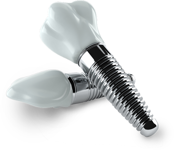 Dental implants