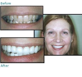 Before and after dental patient pictures