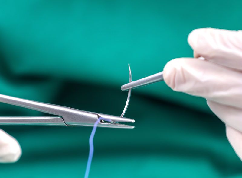 Sutures and surgical tools