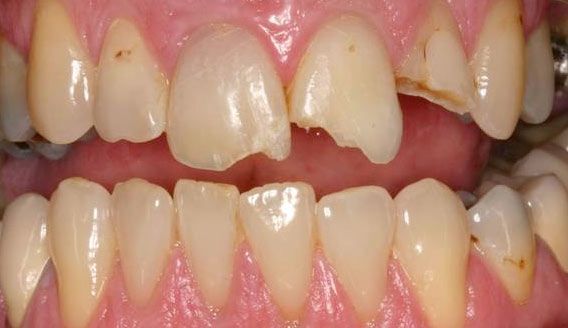 before dental care
