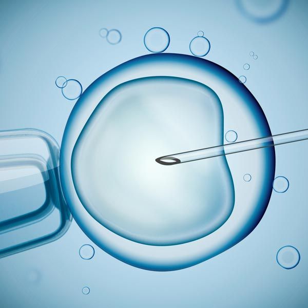 IVF