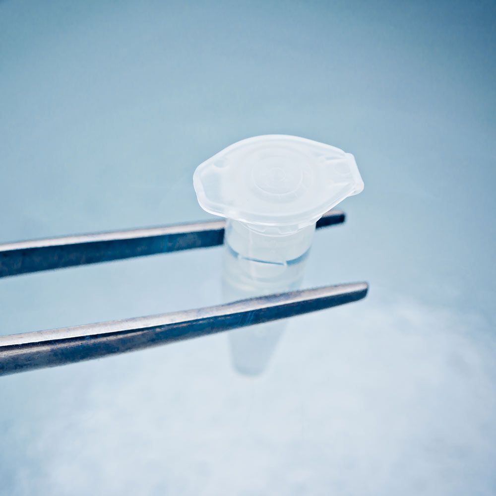 Fertility preservation
