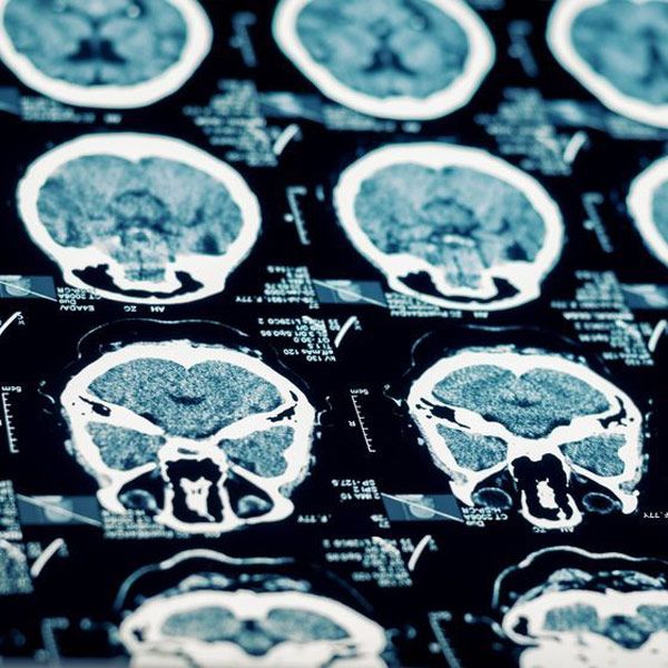 Brain scans