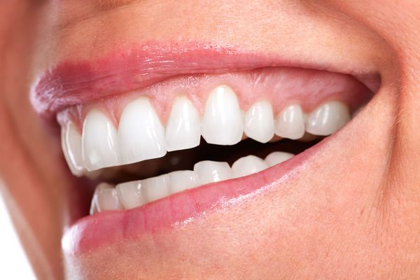 Gum Lift: A closeup of a smiling mouth's teeth and gums.