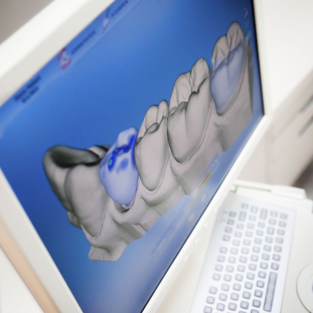 Monitor showing dental software