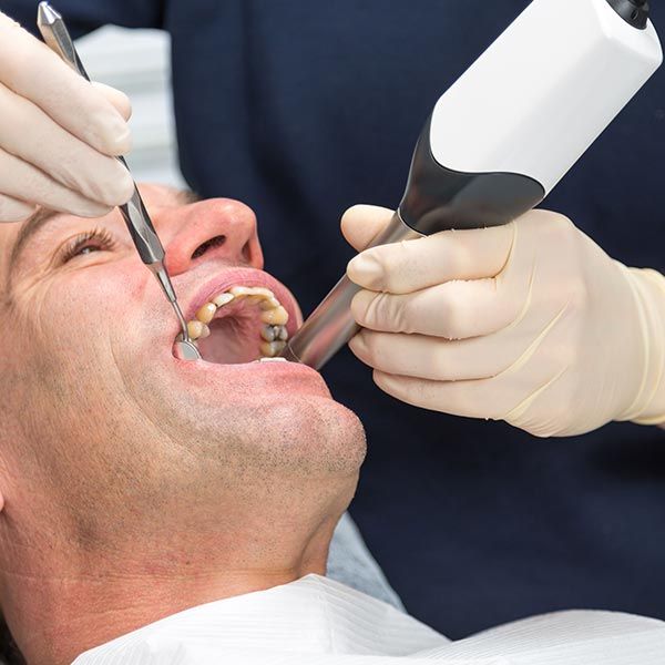 dental exam using an intraoral camera