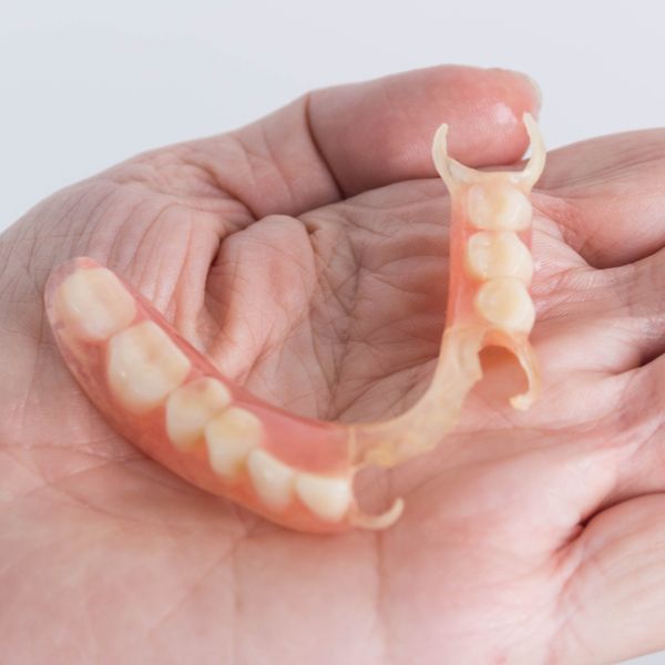 Overdenture
