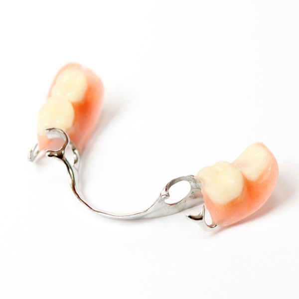 Partial denture