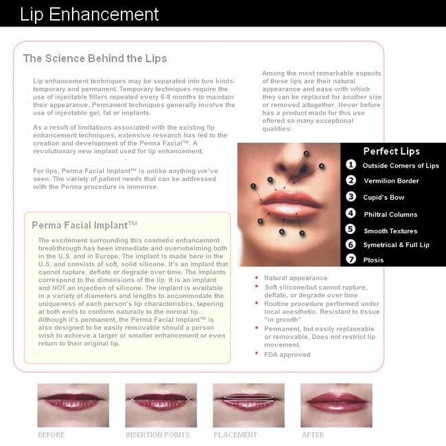 Perma facial implants advertisement