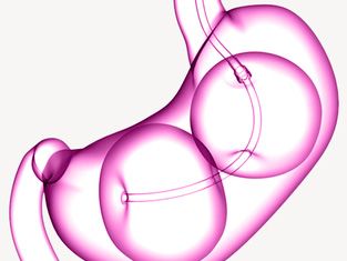 ReShape™ Non-surgical Weight Loss