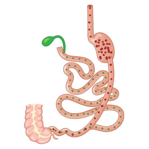 Biliopancreatic Diversion with Duodenal Switch