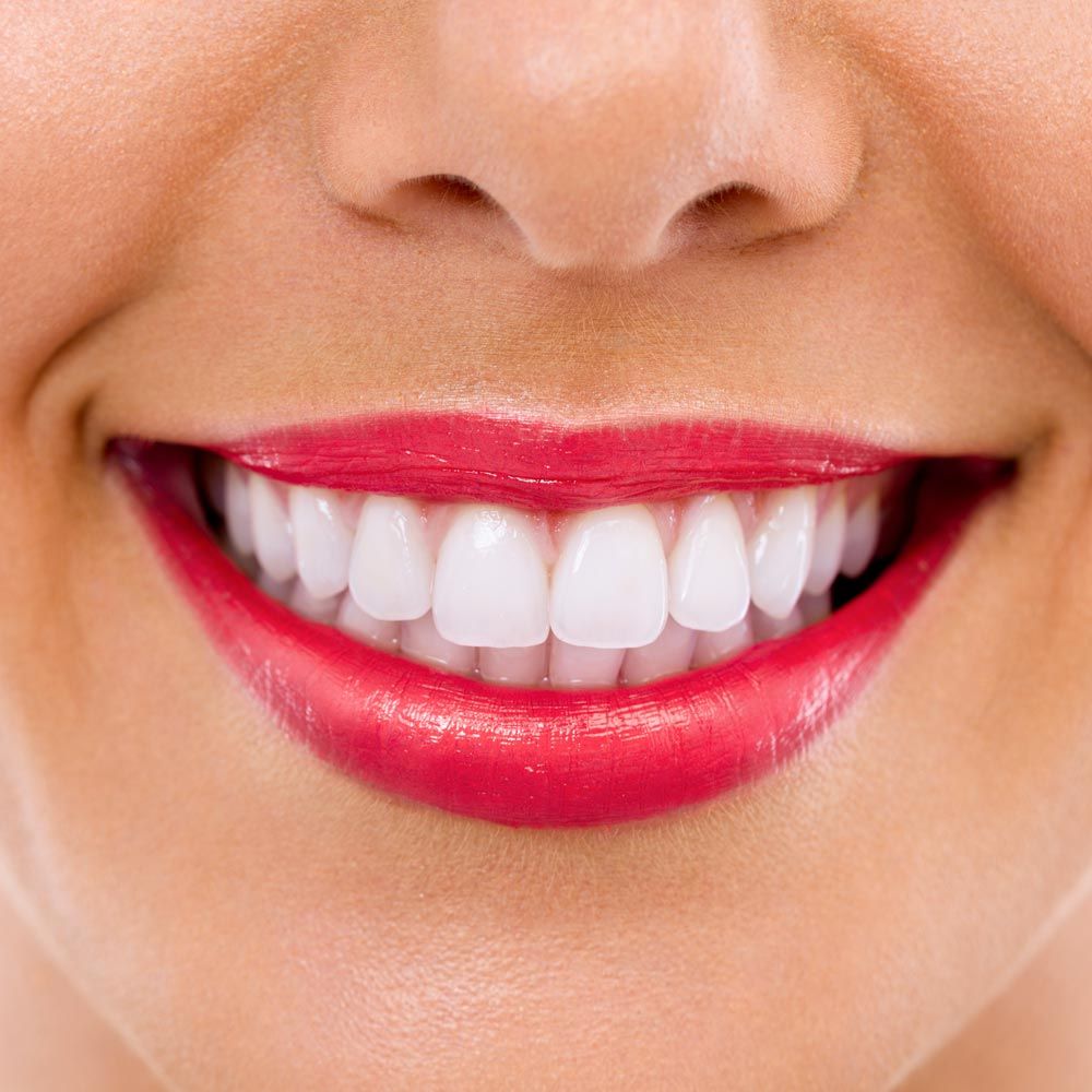 Veneers Cost Philadelphia, PA Bucks County Doylestown, PA