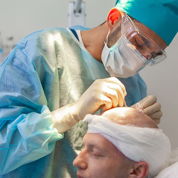 Doctor placing follicles into patient's scalp