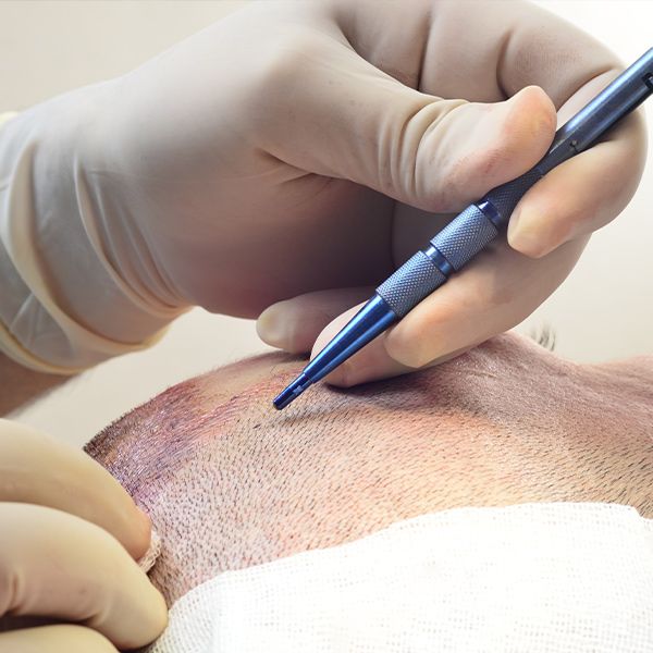 Closeup of mega-session