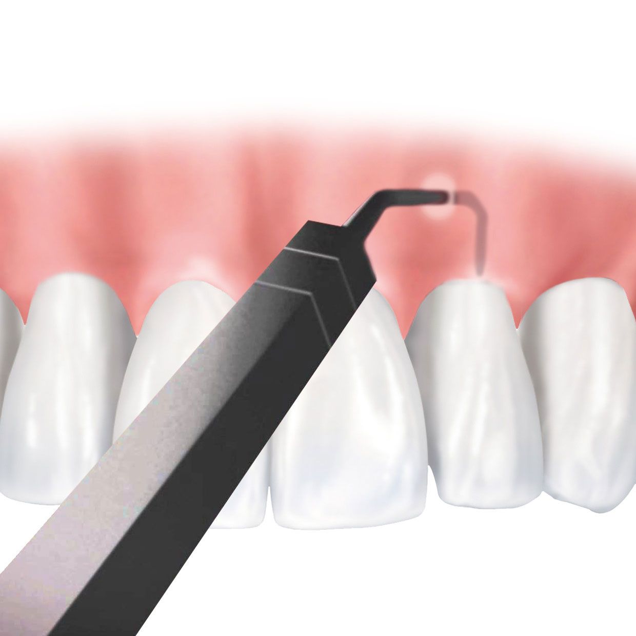 Chao Pinhole Surgical Technique®