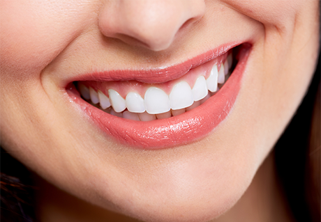 Close up of woman's very white teeth