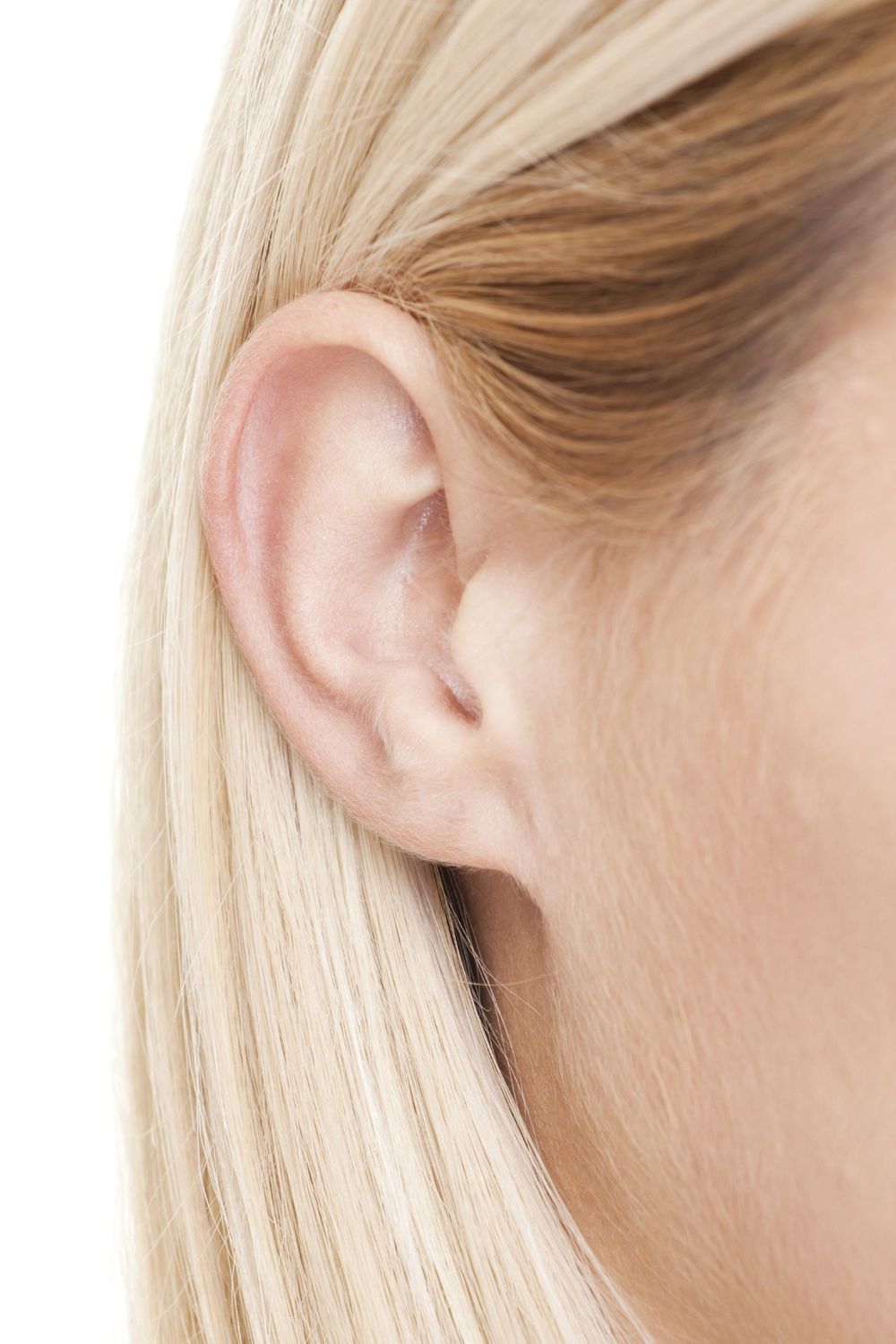 image of woman with otoplasty