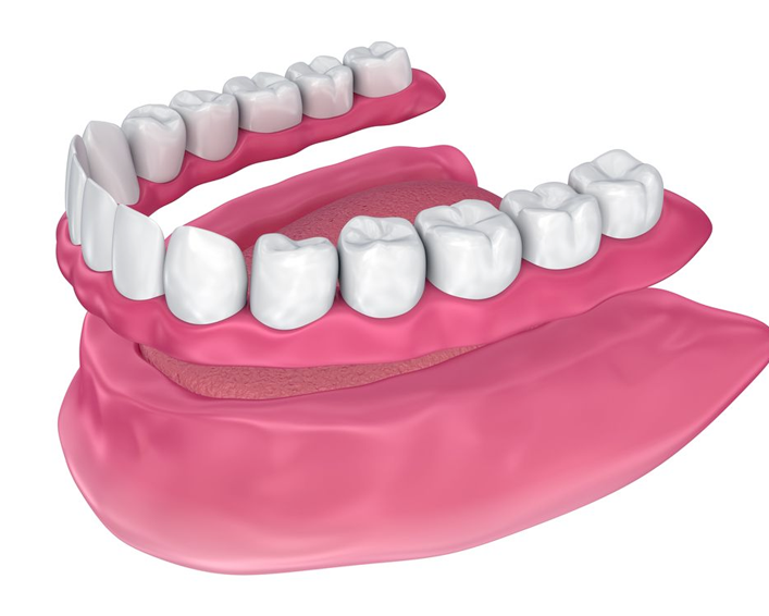 dentures illustration