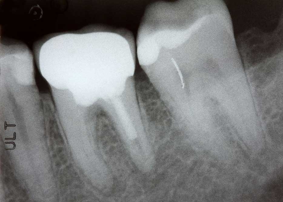 A man with a healthy smile