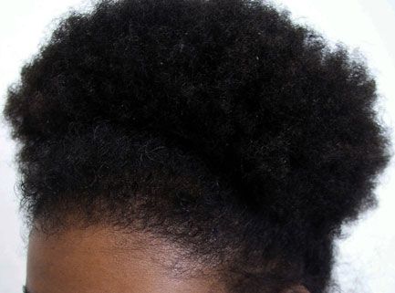 after hair restoration