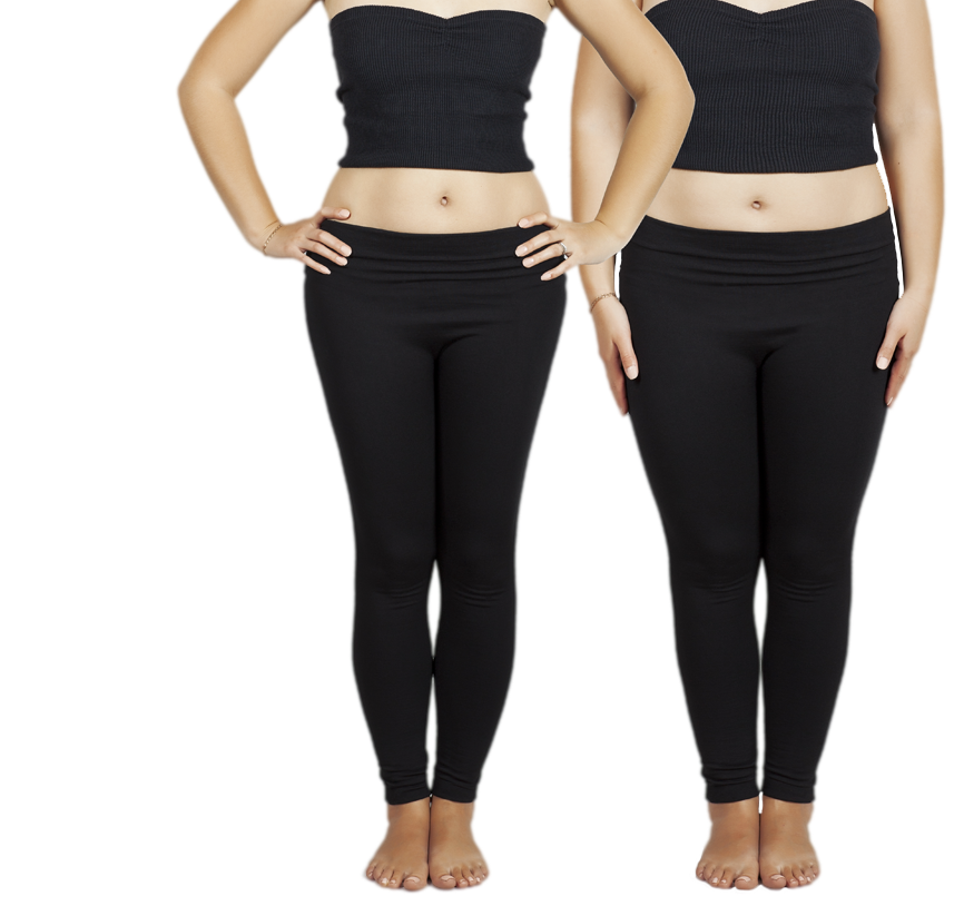 Woman's legs before and after lower body lift