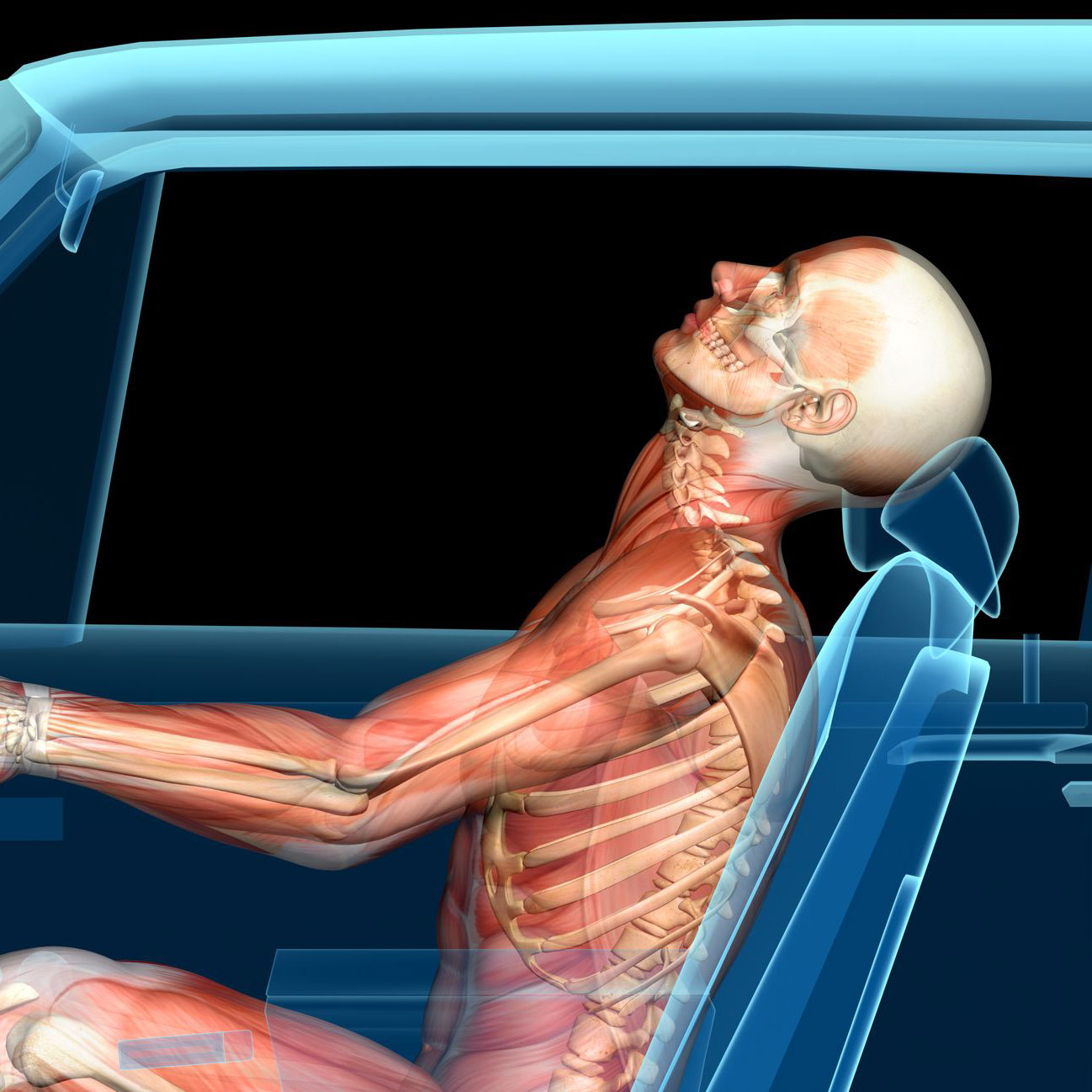 Depiction of whiplash effects on body