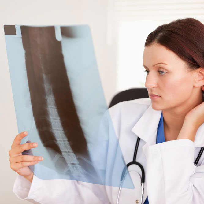 Female medical professional looks at x-ray of spine at her desk