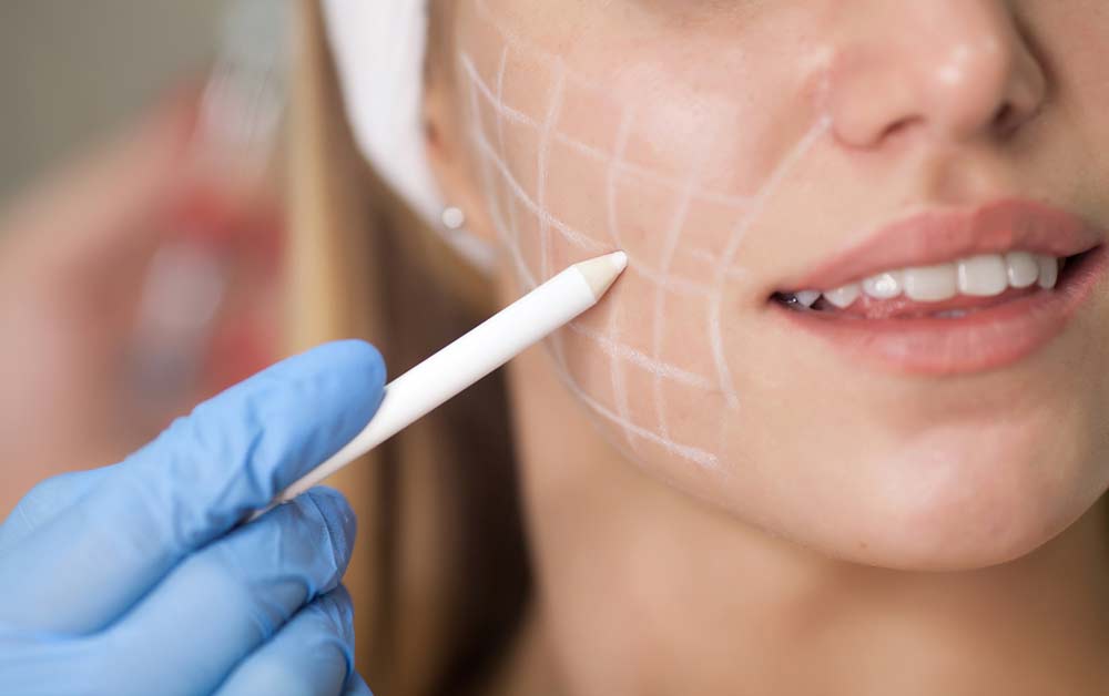 skin tightening