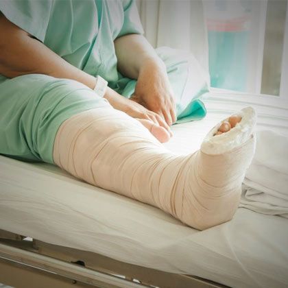 Patient in hospital bed with leg in cast