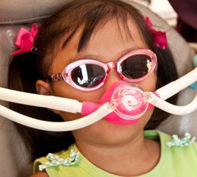 Young girl undergoing nitrous oxide sedation