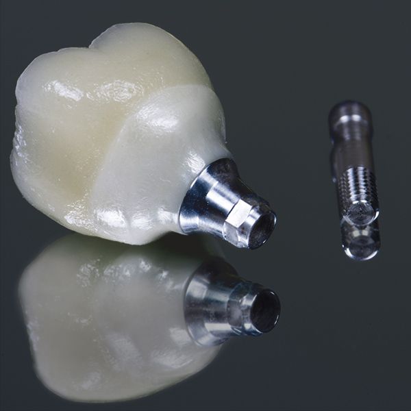 implant-supported dental crowns