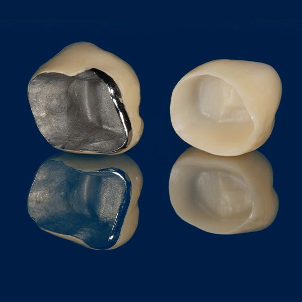dental crowns