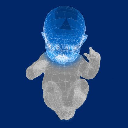 Spasticity/Temporary Body Paralysis