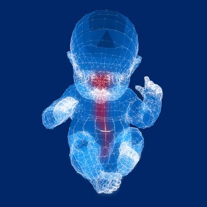 Spinal Cord/Cranial Nerve Damage