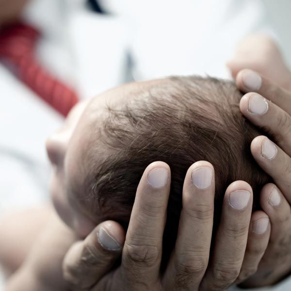 Doctor's hands cradling an infant's head
