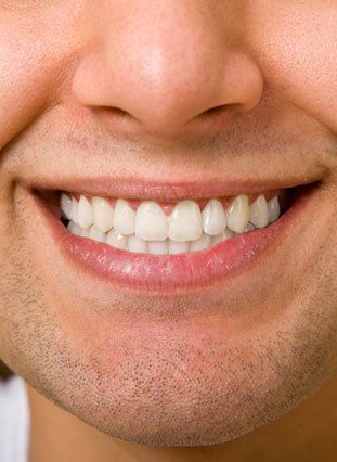 Close-up of a man's smile with symmetrical teeth