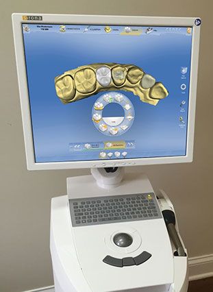 Photo of CEREC system