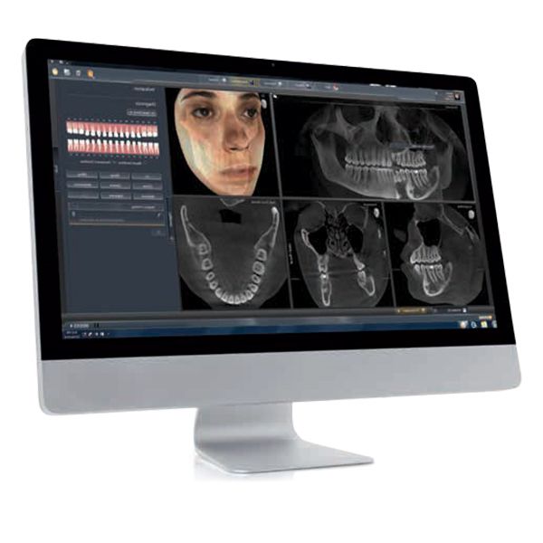 GALILEOS ComfortPLUS Cone Beam Scanner