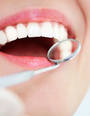 Dental mirror next to woman's white teeth