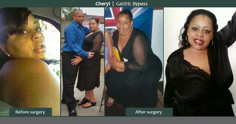 Techniques to burn belly fat image 2