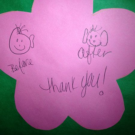 Child drawing of before and after ear surgery