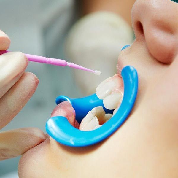 Patient undergoing dental exam