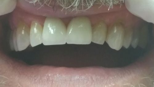 patient after dental procedure
