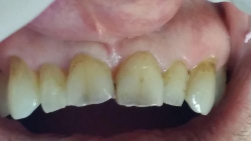 patient before dental procedure