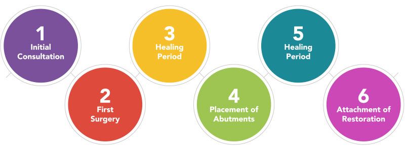 Dental implants timeline