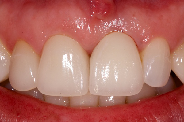 dentists dental implants austin tx 38th street dental