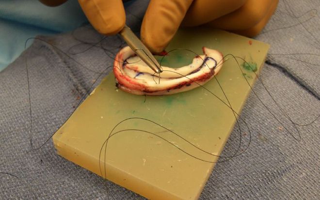 Treatment of ear deformities.